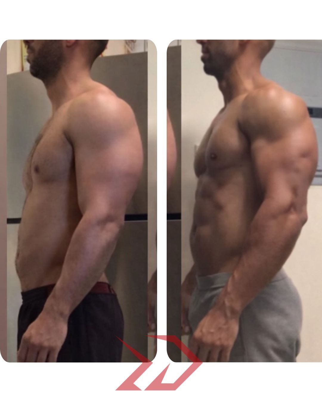 Rafael, antes e depois, rosto preservado